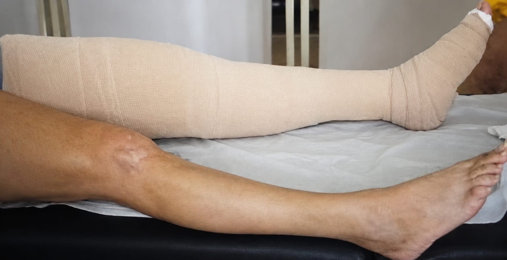 Lymphedema & Oncology Care